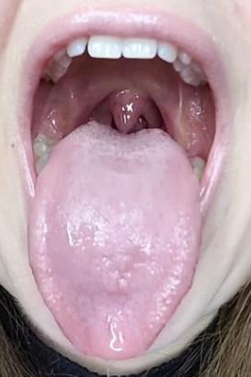 Enjoy My Tongue And Uvula - Screenshot 1 of 4 - Fetish