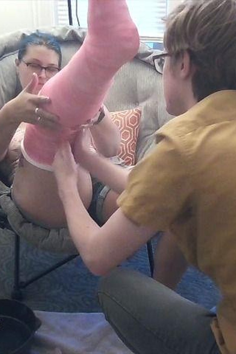 Applying A Pink Long Leg Cast - Screenshot 1 of 4 - Cast Fetish