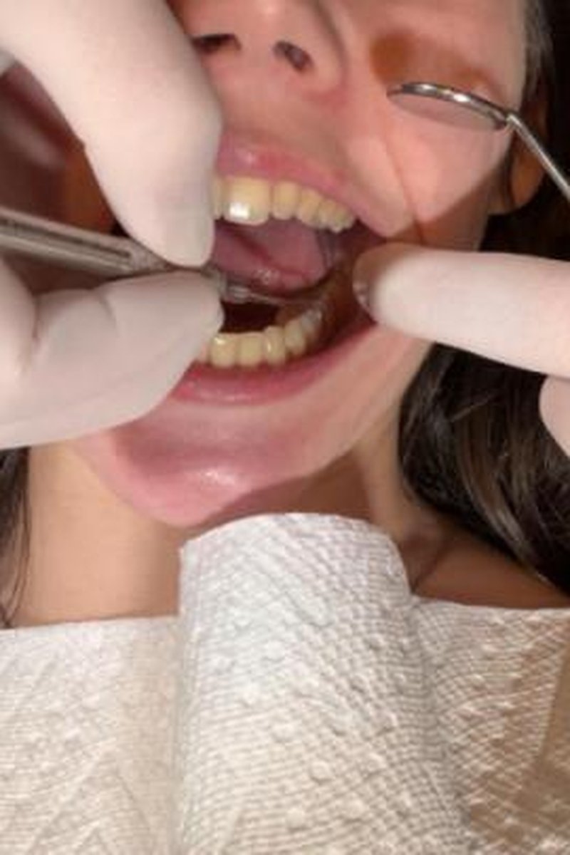 TP-manyvidsnursebunny69-dr-canada-cleans-nurse-bunnys-teeth-close-view-1080p
