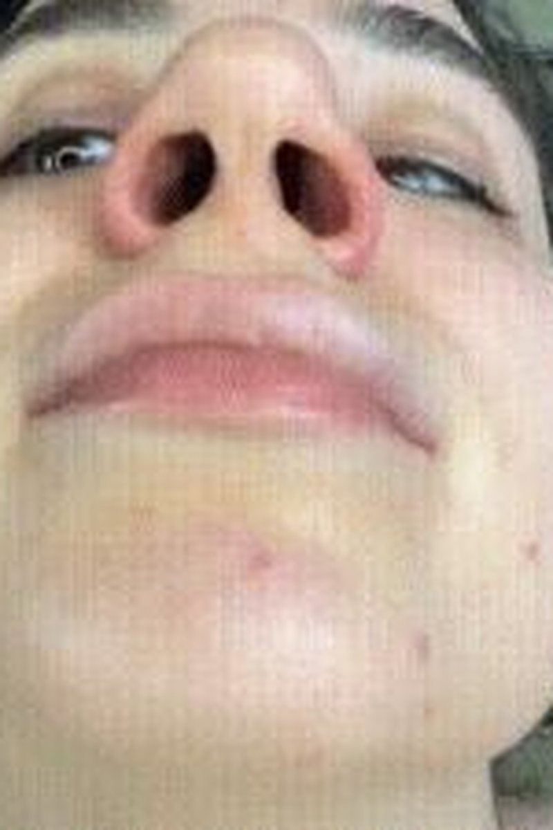 Big Nose Picking - Screenshot 1 of 4 - Boogers