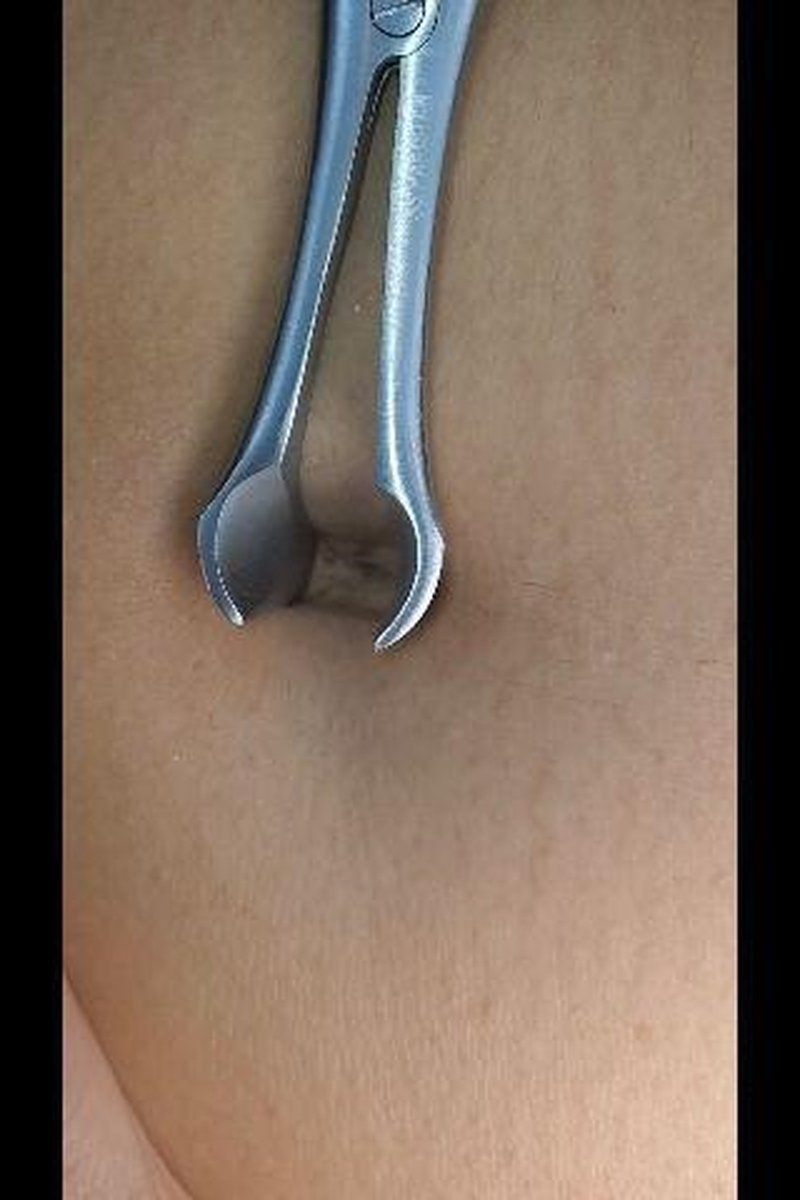 Deep Bellybutton Exploration W/Tools - Screenshot 1 of 4 - Asian