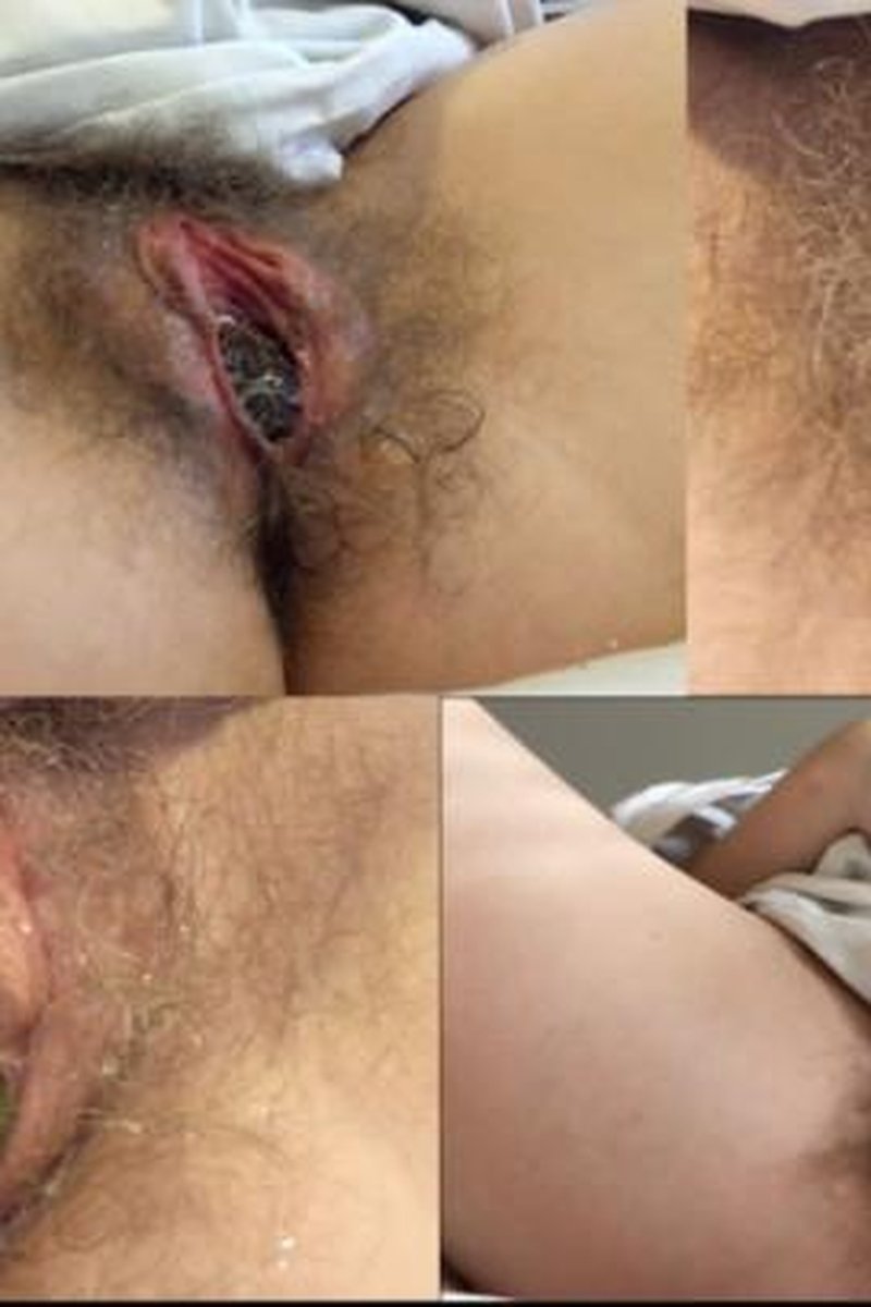 Swollen Hairy Pussy Birthing Objects Compilation - Screenshot 1 of 4 - Hairy Pussy