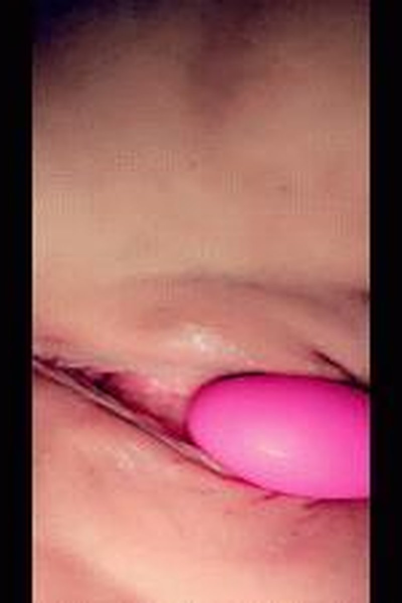 Rabbit - Screenshot 1 of 4 - Clit
