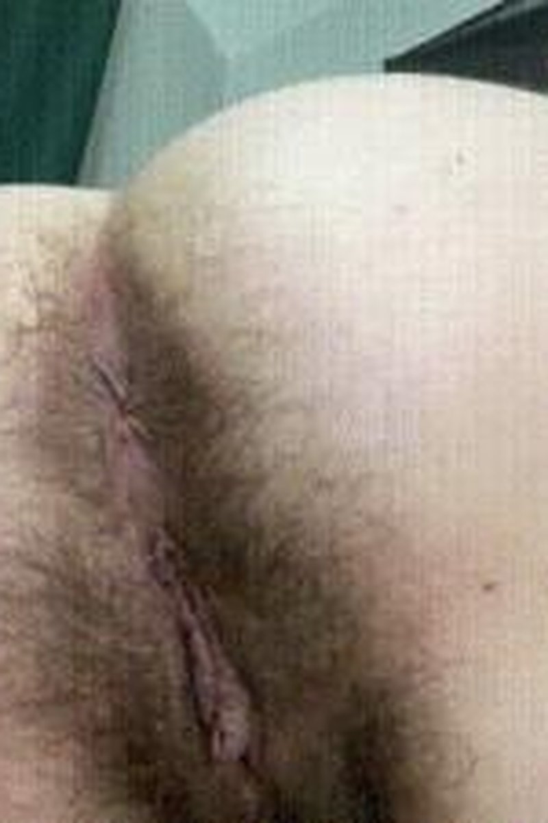 Beaucoup Butthole - Screenshot 1 of 4 - Ass Fetish