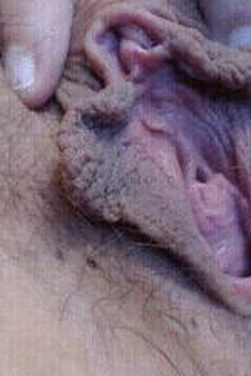 Large Labia Lady - Screenshot 1 of 4 - Huge Labia