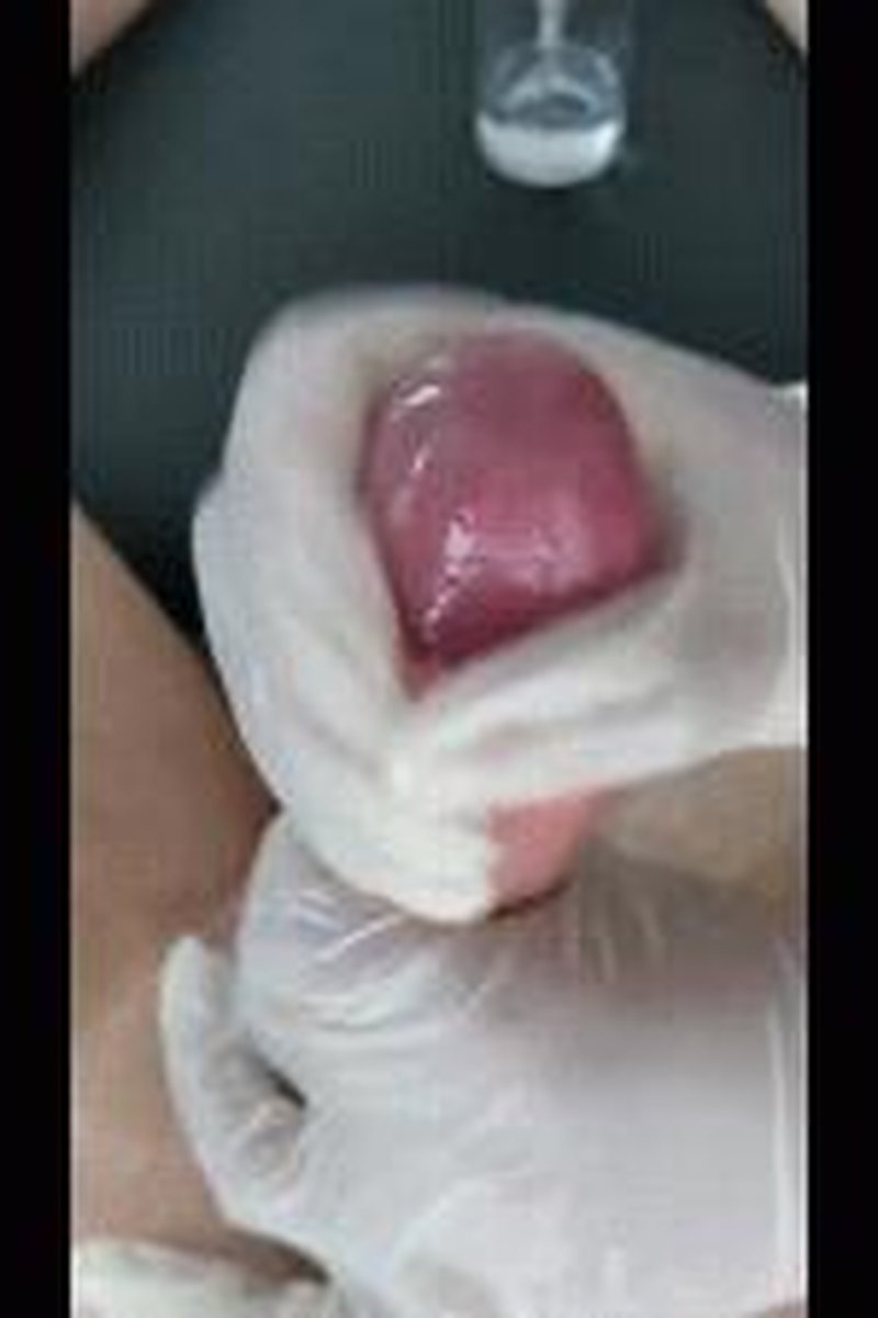 Erectile Dysfunction Test - Screenshot 1 of 4 - Doctor