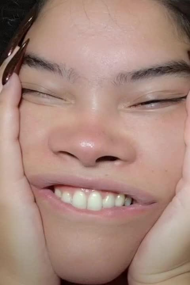 Distorted Face - Screenshot 1 of 4 - Face Fetish