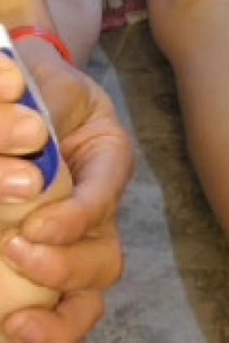 Guedel - Screenshot 1 of 4 - Medical Fetish