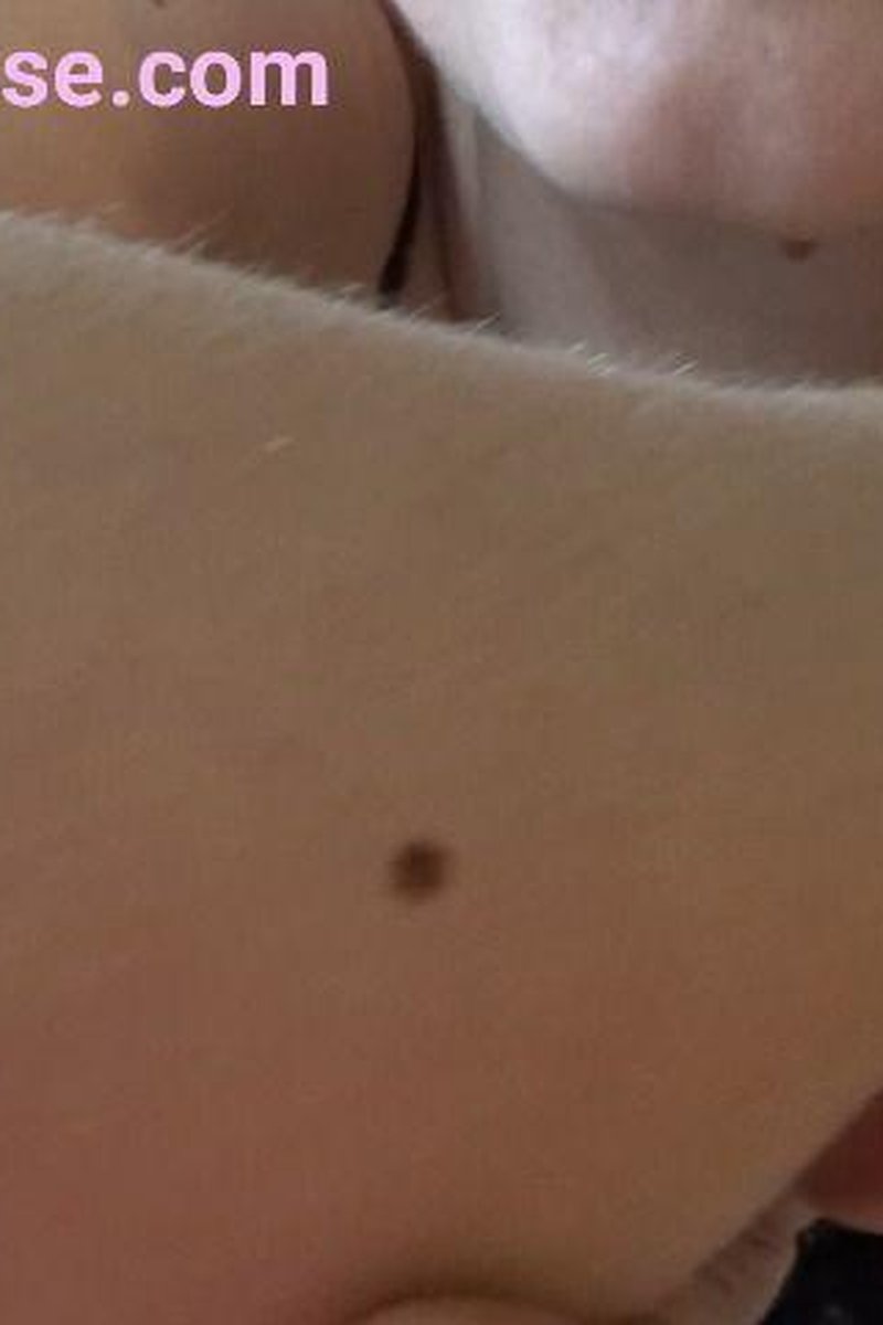 Freckle Fetish - Screenshot 1 of 4 - Body Worship