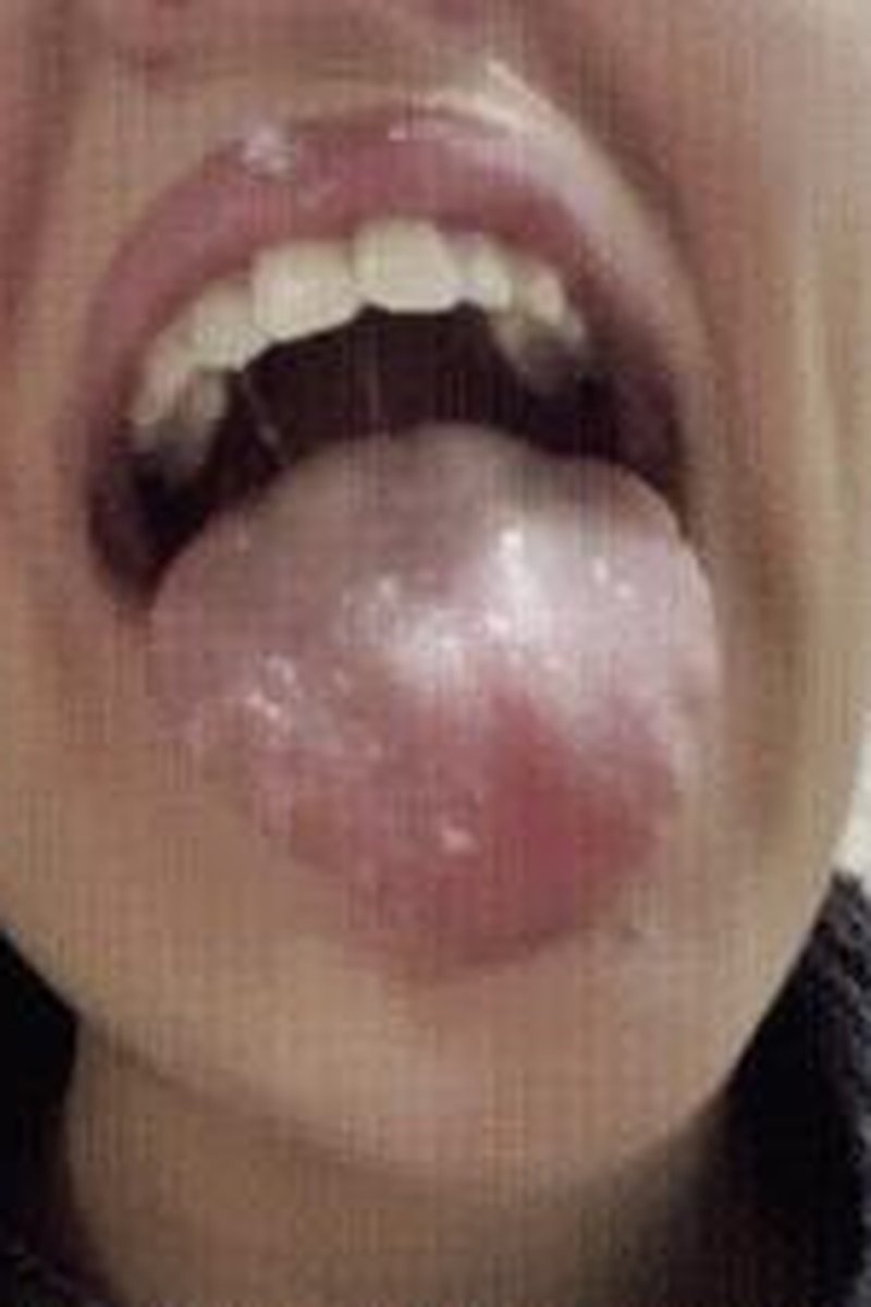 POV Mouth Exploration With Peko Lux - Screenshot 1 of 4 - Body Worship