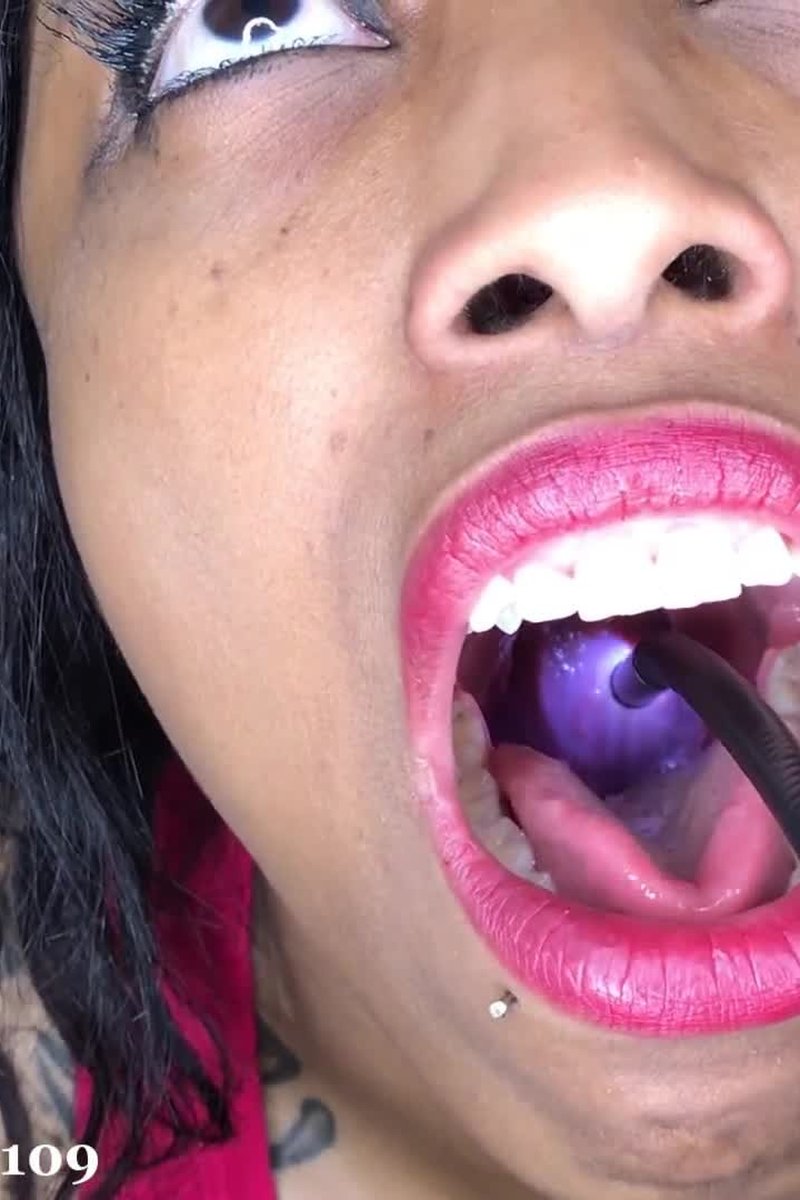 Endoscope Time - Screenshot 1 of 4 - Fetish