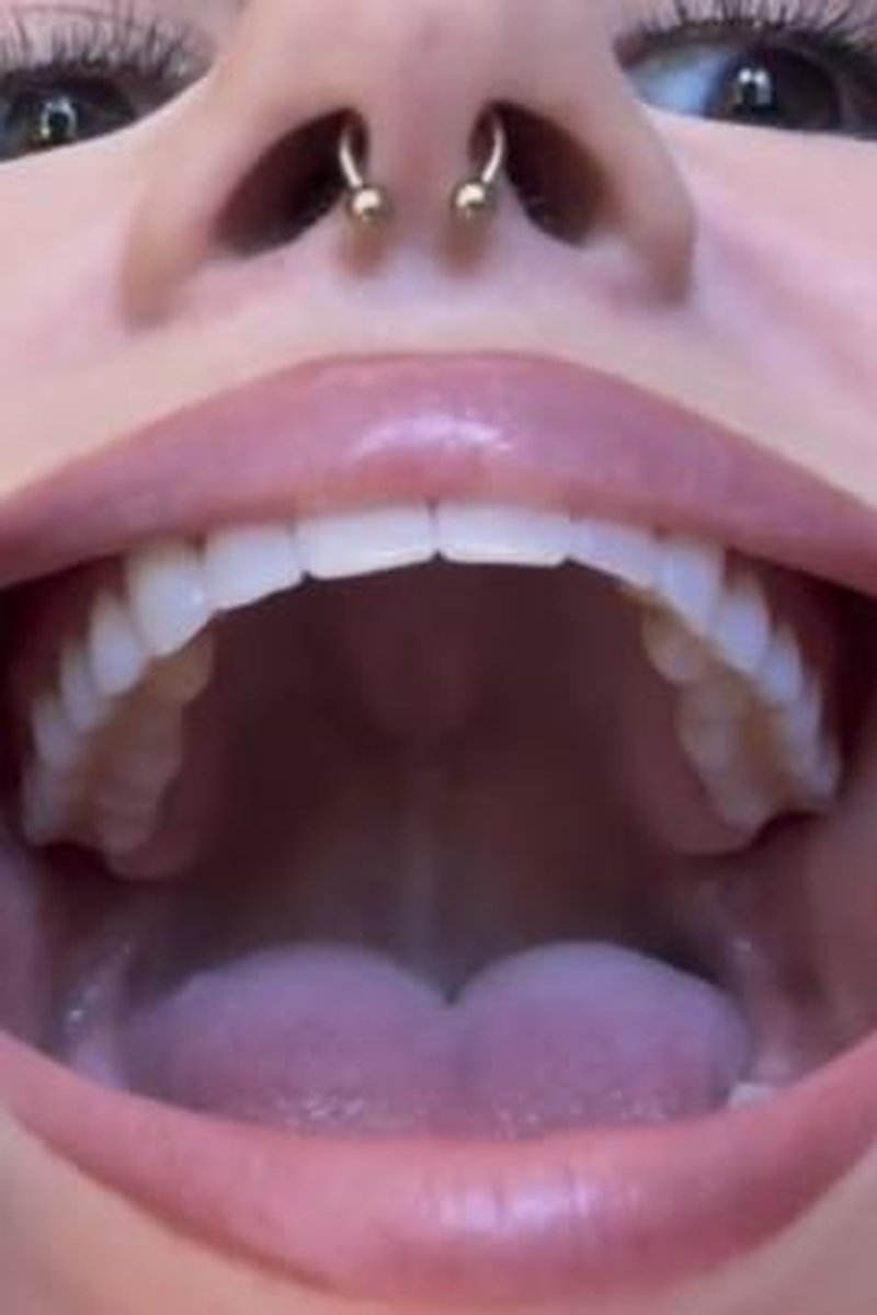 Dental Fetish Teeth Dental Work Tour - Screenshot 1 of 4 - Dental