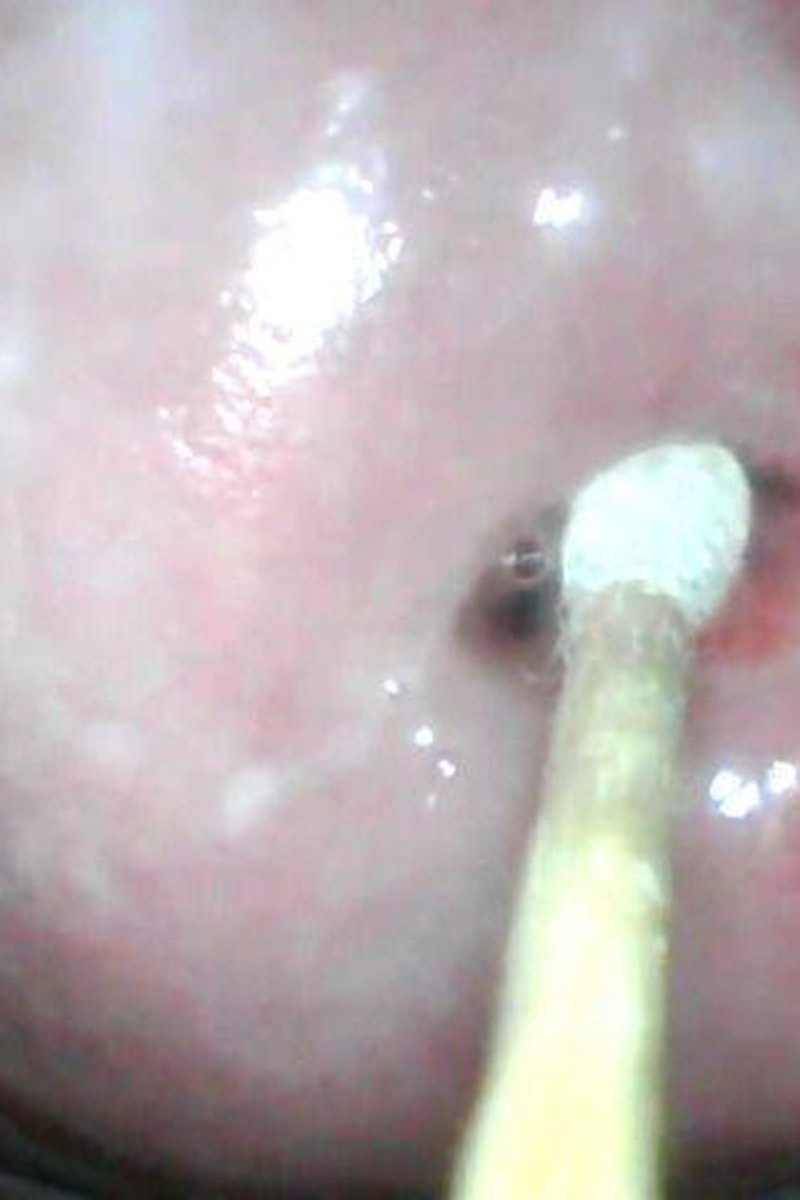 Cervix Quickie - Screenshot 1 of 4 - Medical Fetish