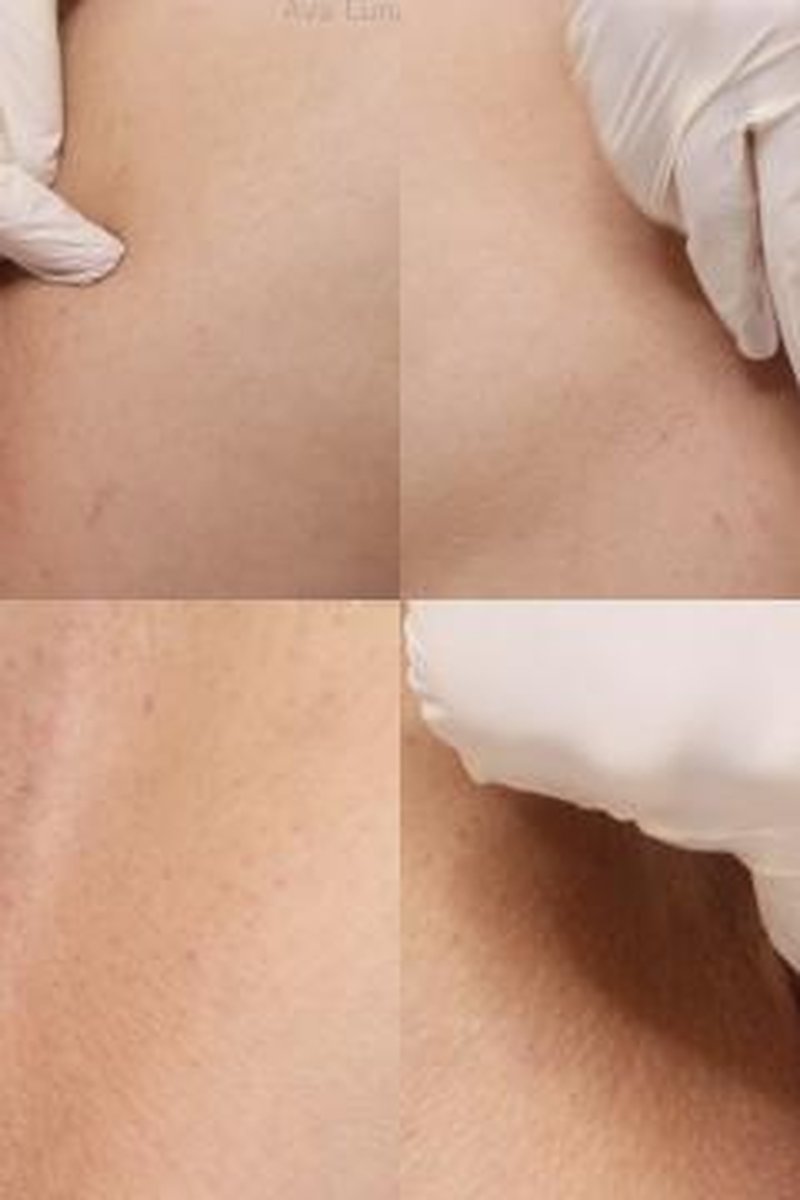 4K: Self Examination - Screenshot 1 of 4 - Gyno Exam