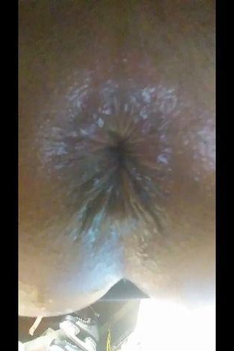Training - Screenshot 1 of 4 - Anal