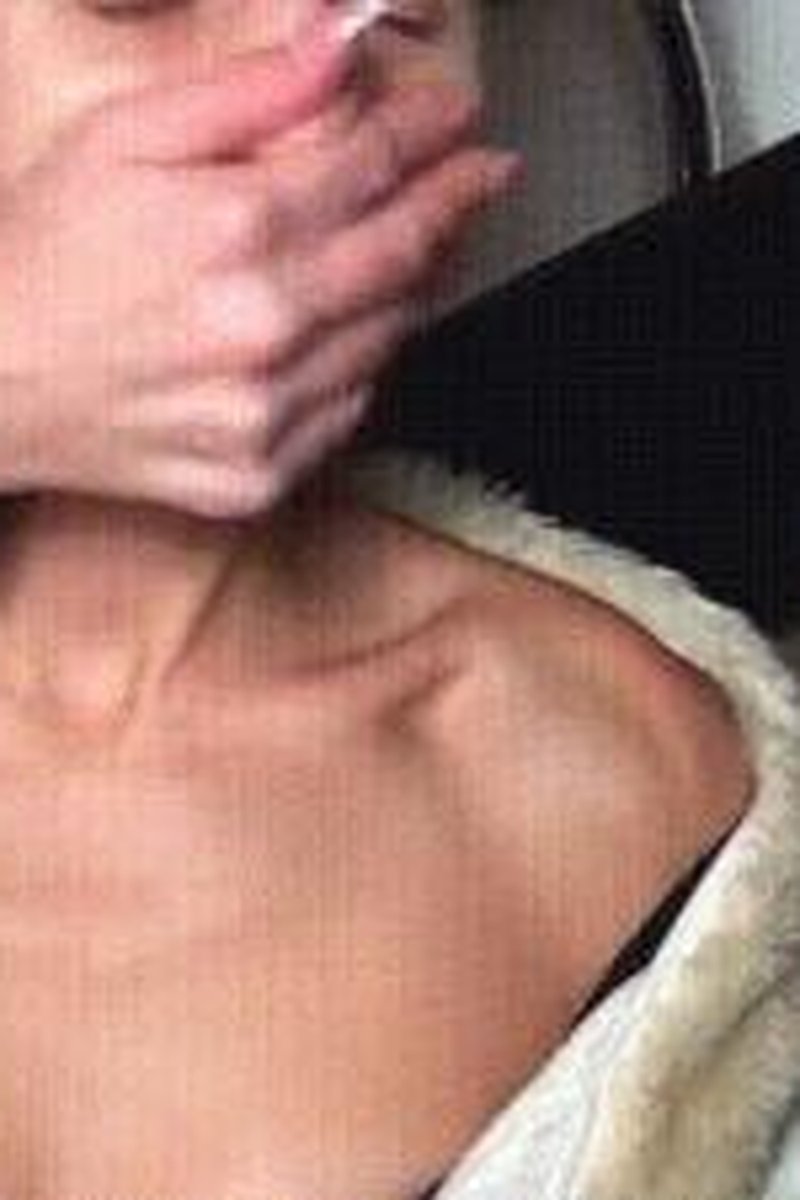 Assault - Screenshot 1 of 4 - Choking