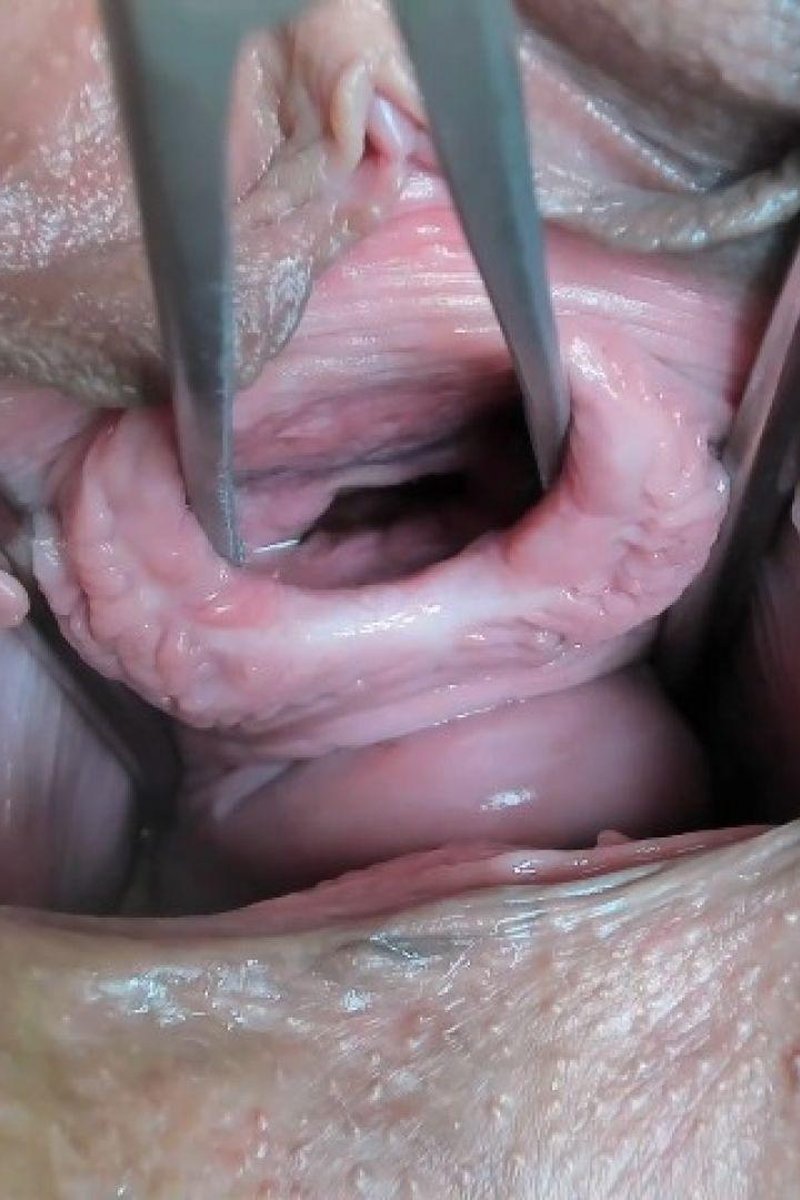 Andrada - Screenshot 1 of 4 - Close Up