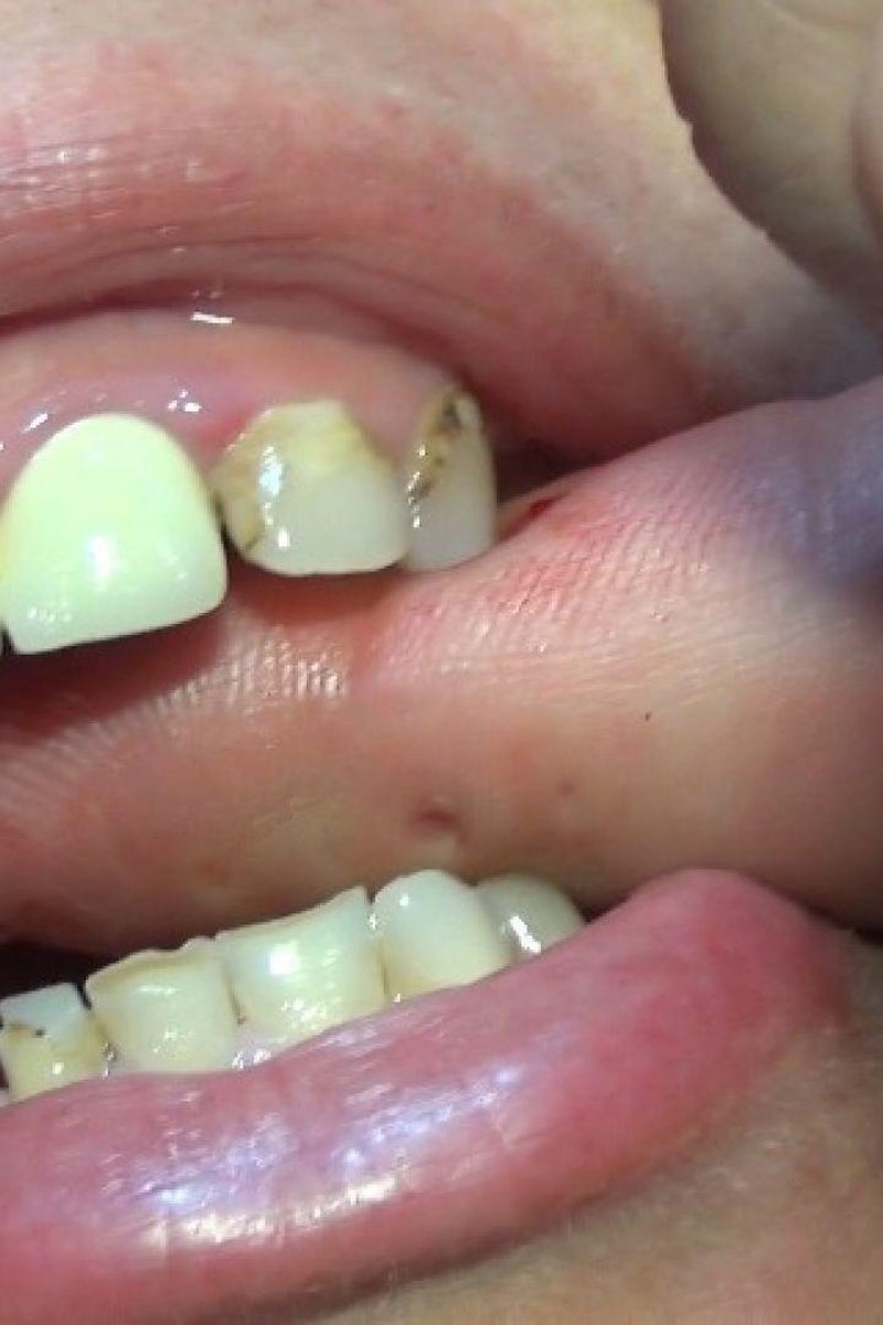 Biting 10 - Screenshot 1 of 4 - BDSM