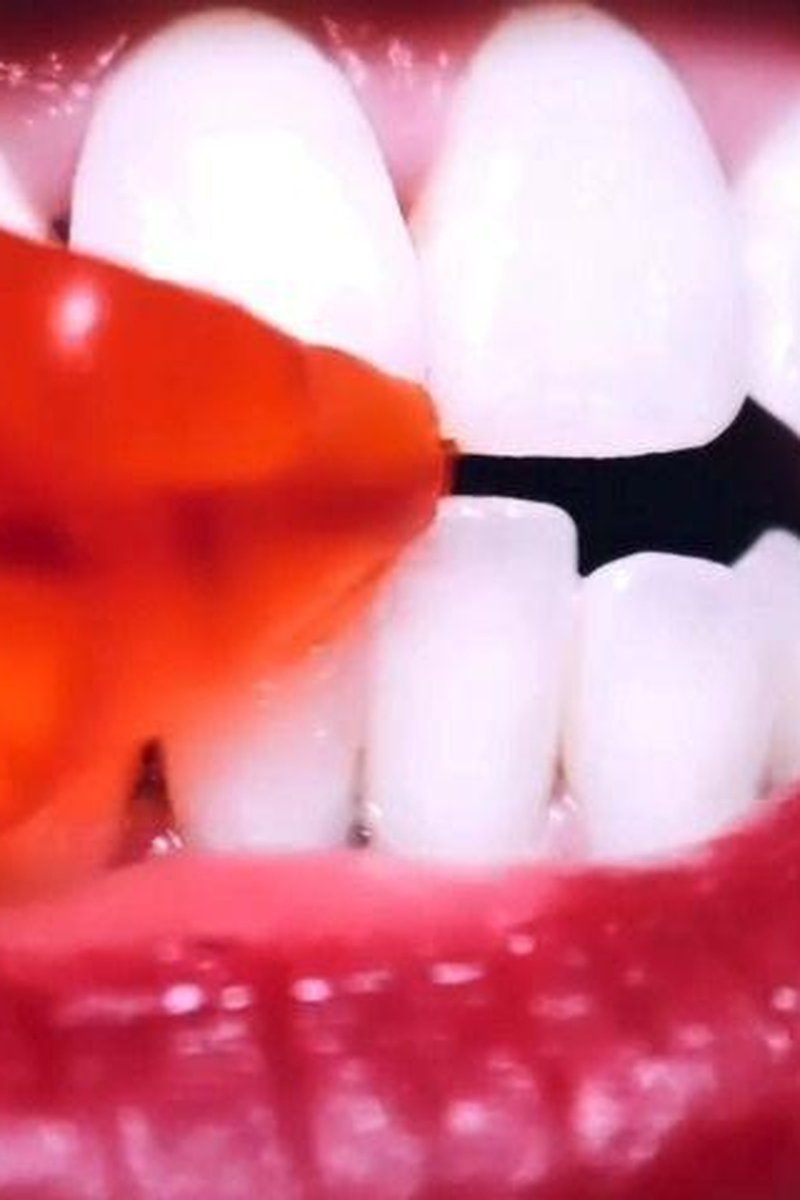 Teeth Fetish - Screenshot 1 of 4 - Chewing