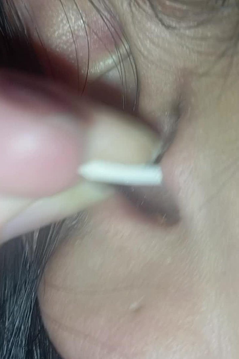 Ear Cleaning - Screenshot 1 of 4 - Amateur