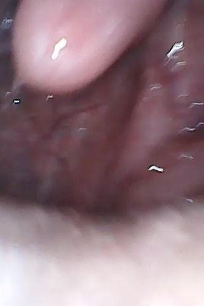 Endoscopy Camera - Screenshot 1 of 4 - Medical Play