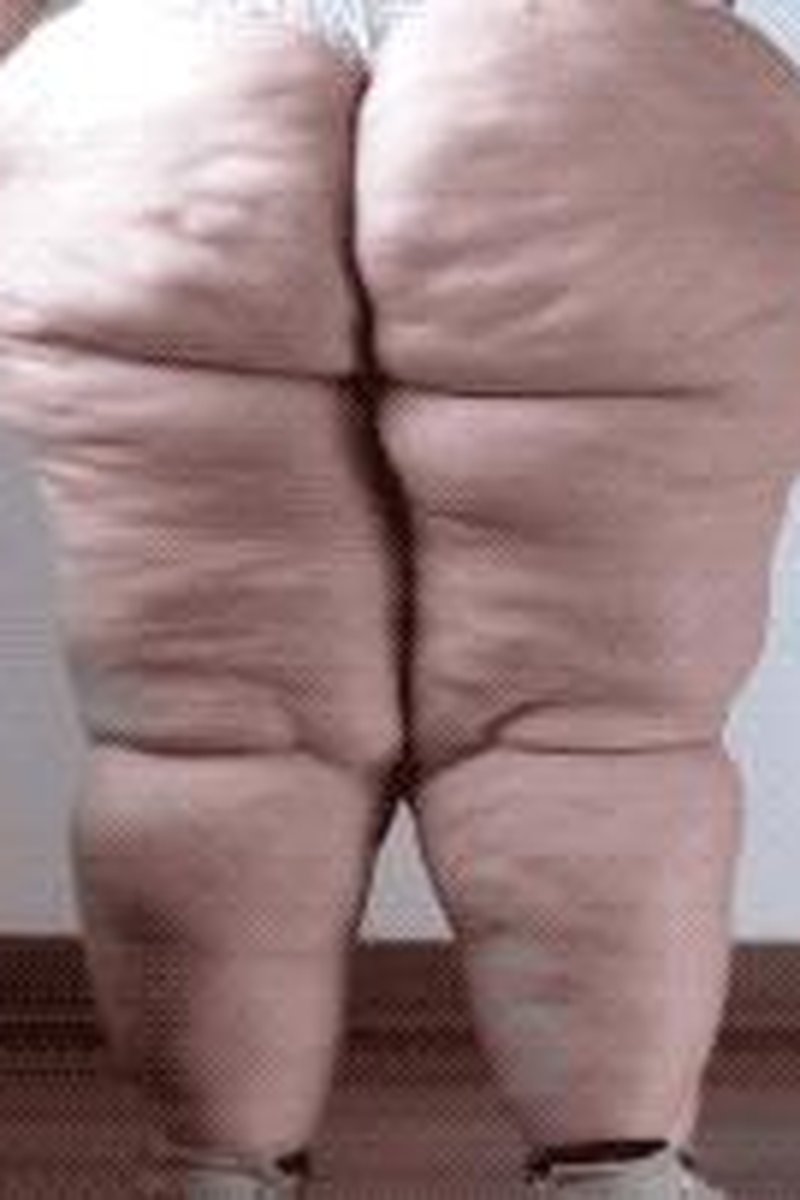 Stretch Out - Screenshot 1 of 4 - BBW