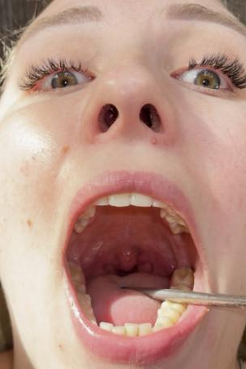 Doctor's Deep Oral Examination POV - Screenshot 1 of 4 - Brown Hair
