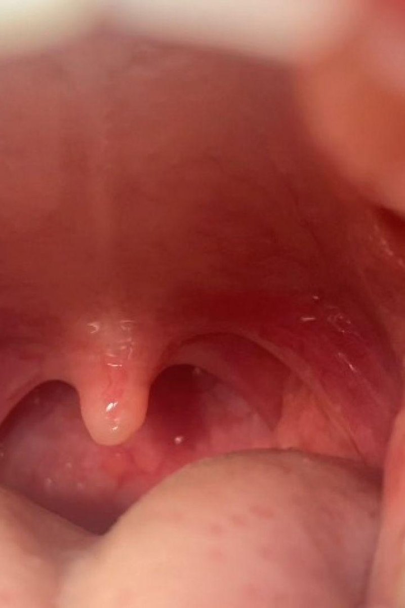 Exploring My Uvula - Screenshot 1 of 4 - Mouth Fetish