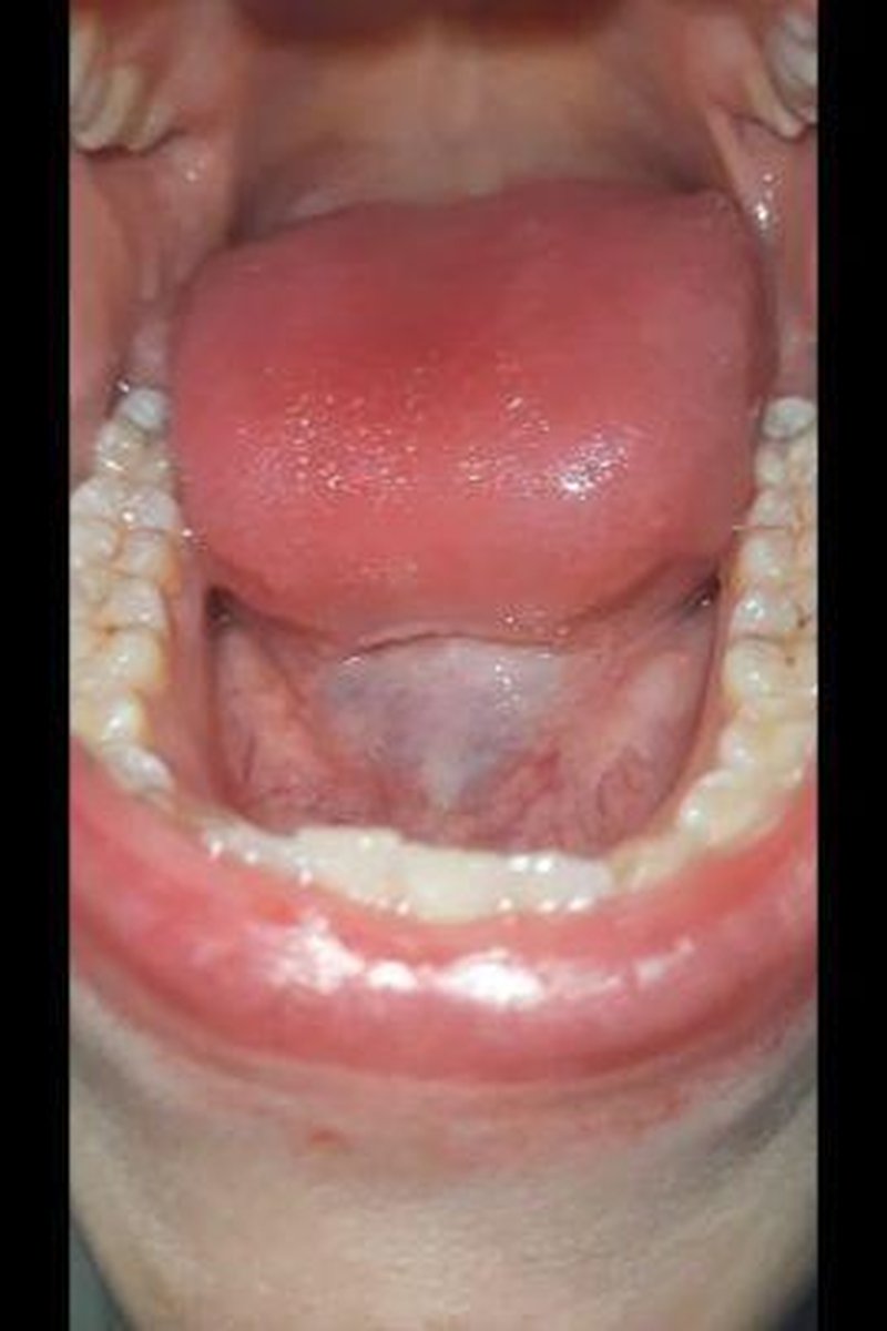 Dirty Teeth Teeth - Screenshot 1 of 4 - Dirtyteeth