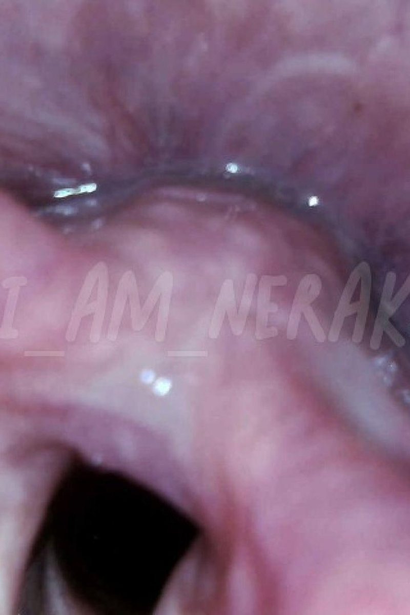 Windpipe - Screenshot 1 of 4 - Endoscopethroat