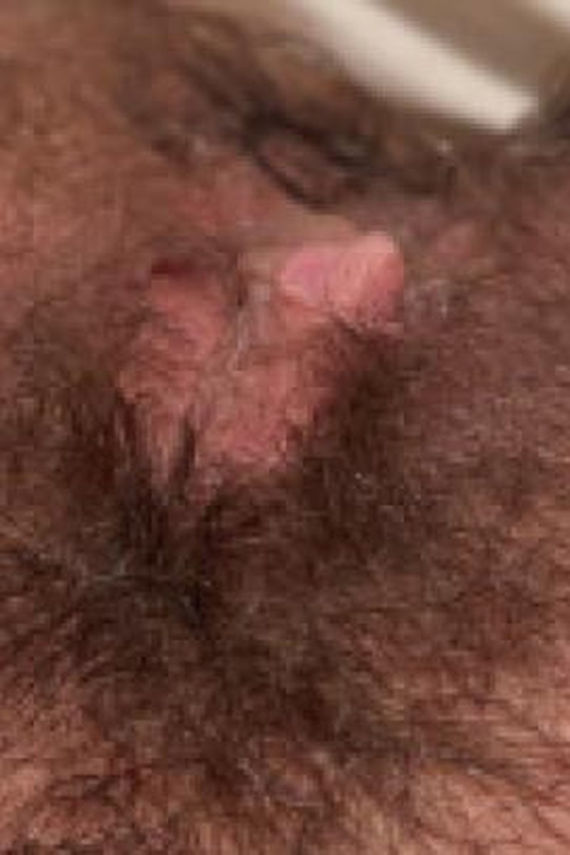 Ftm Fingering - Screenshot 1 of 4 - Boi Pussy