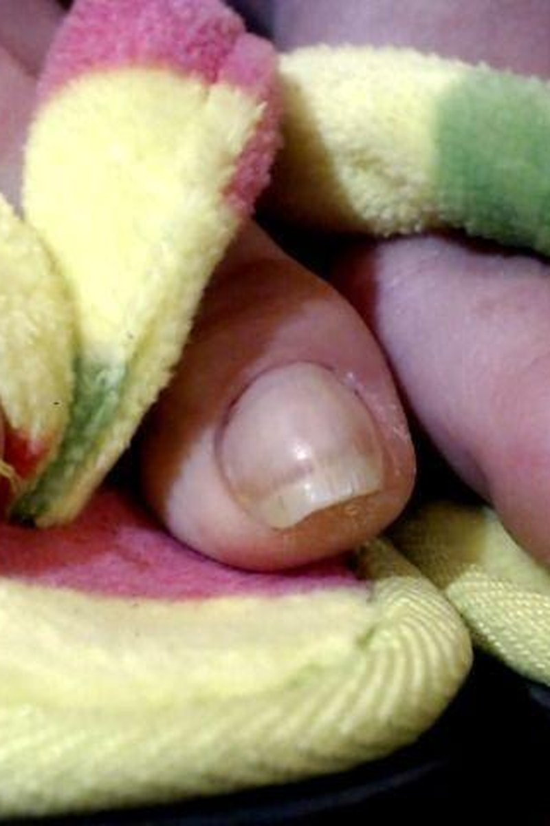 Long Toenails - Screenshot 1 of 4 - Shoes