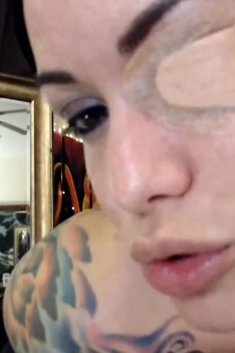 Eye Patch Fetish Part 2 - Screenshot 1 of 4 - Amateur