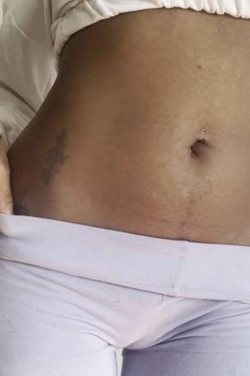 Bellybutton Addicts - Screenshot 1 of 4 - Belly Fetish