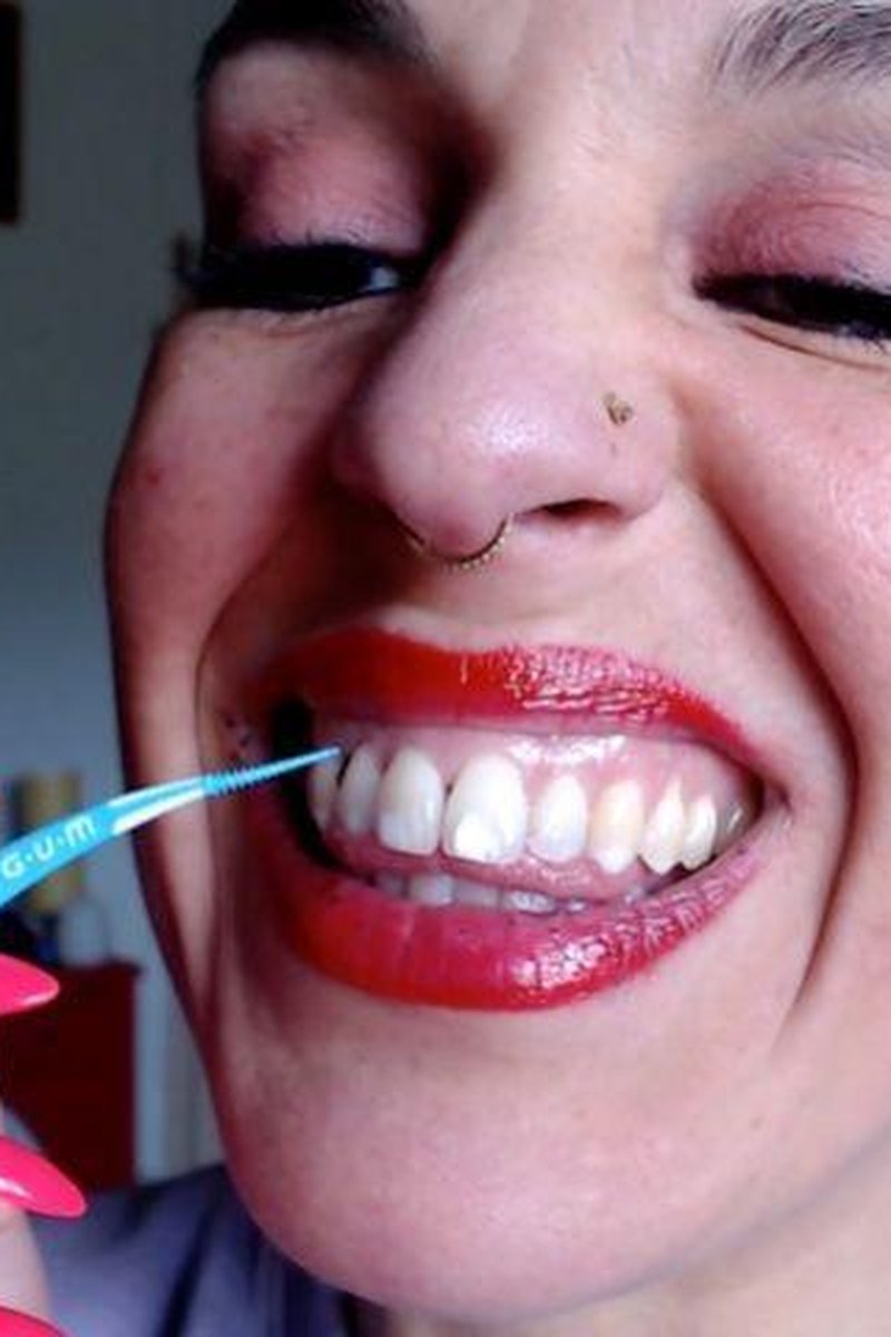 Tooth Picking - Screenshot 1 of 4 - Cleaning