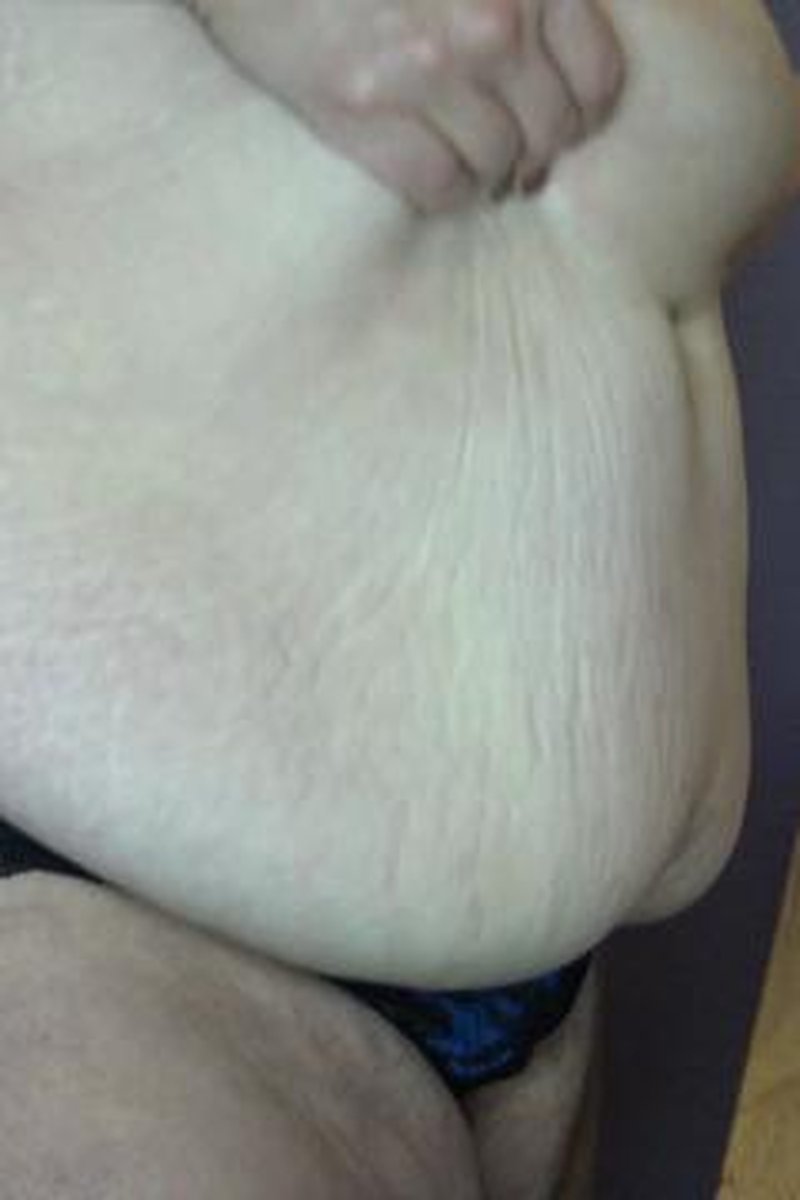 Belly Drops - Screenshot 1 of 4 - BBW
