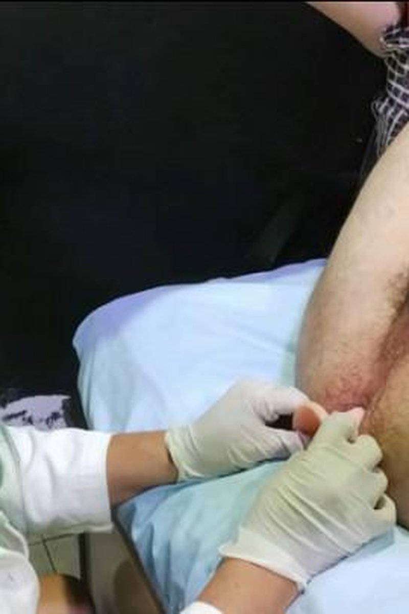 Doctor Performs Anal Exam With Long Dildo - Screenshot 1 of 4 - Amateur