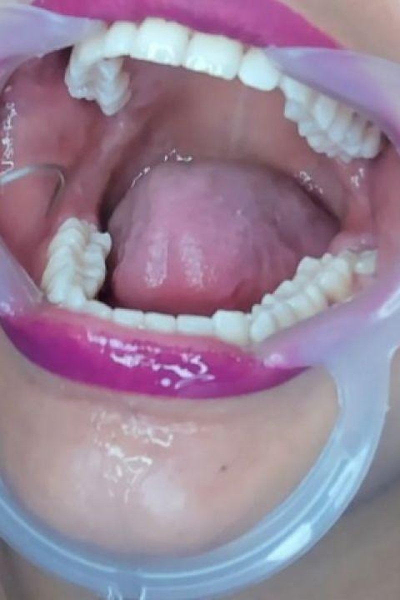 Dentist - Screenshot 1 of 4 - Gagging
