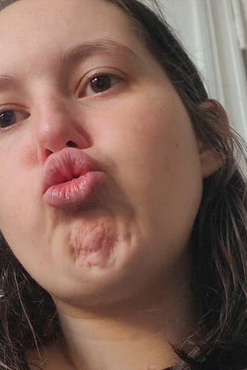 Duck Lips - Screenshot 1 of 4 - Nerdy Nami
