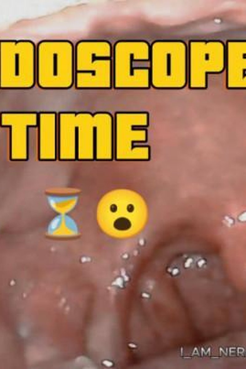 Endoscope Time - Screenshot 1 of 4 - Endoscopethroat