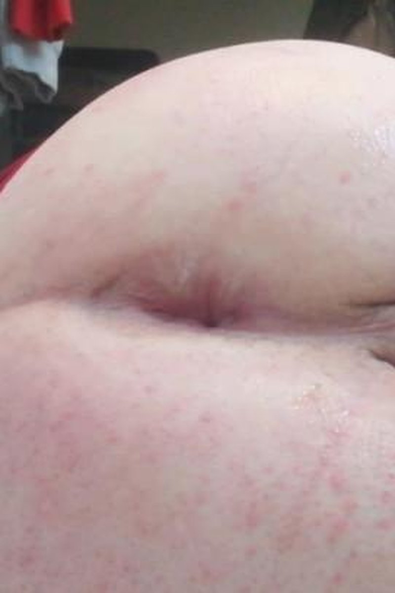 Close Up Fisting - Screenshot 1 of 4 - Anal