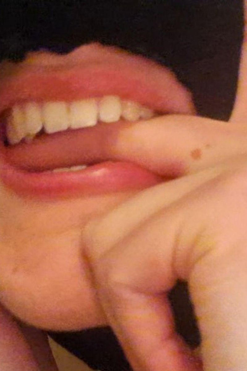 Finger Biting - Screenshot 1 of 4 - Bitemarks