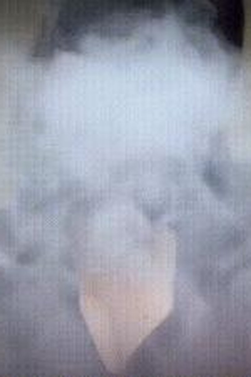Spitting And Vaping - Screenshot 1 of 4 - Beautiful