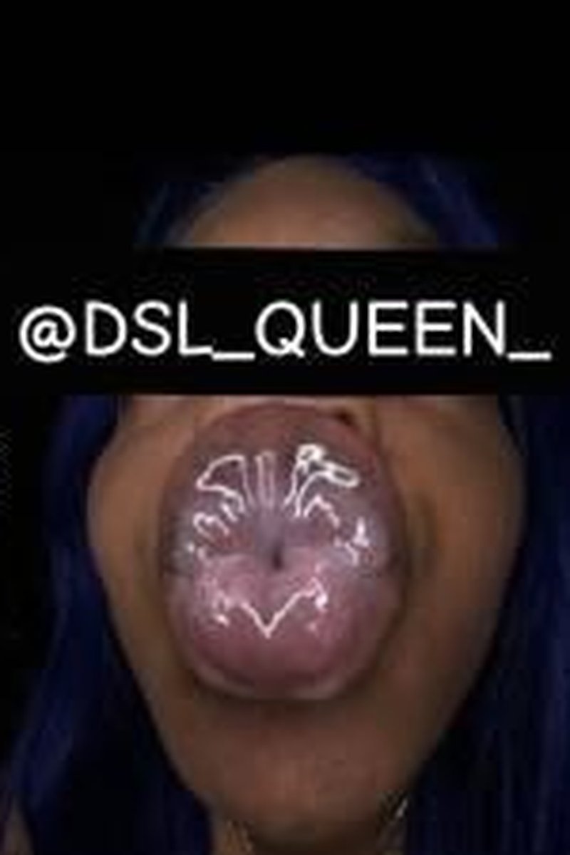 Open Wide - Screenshot 1 of 4 - Black