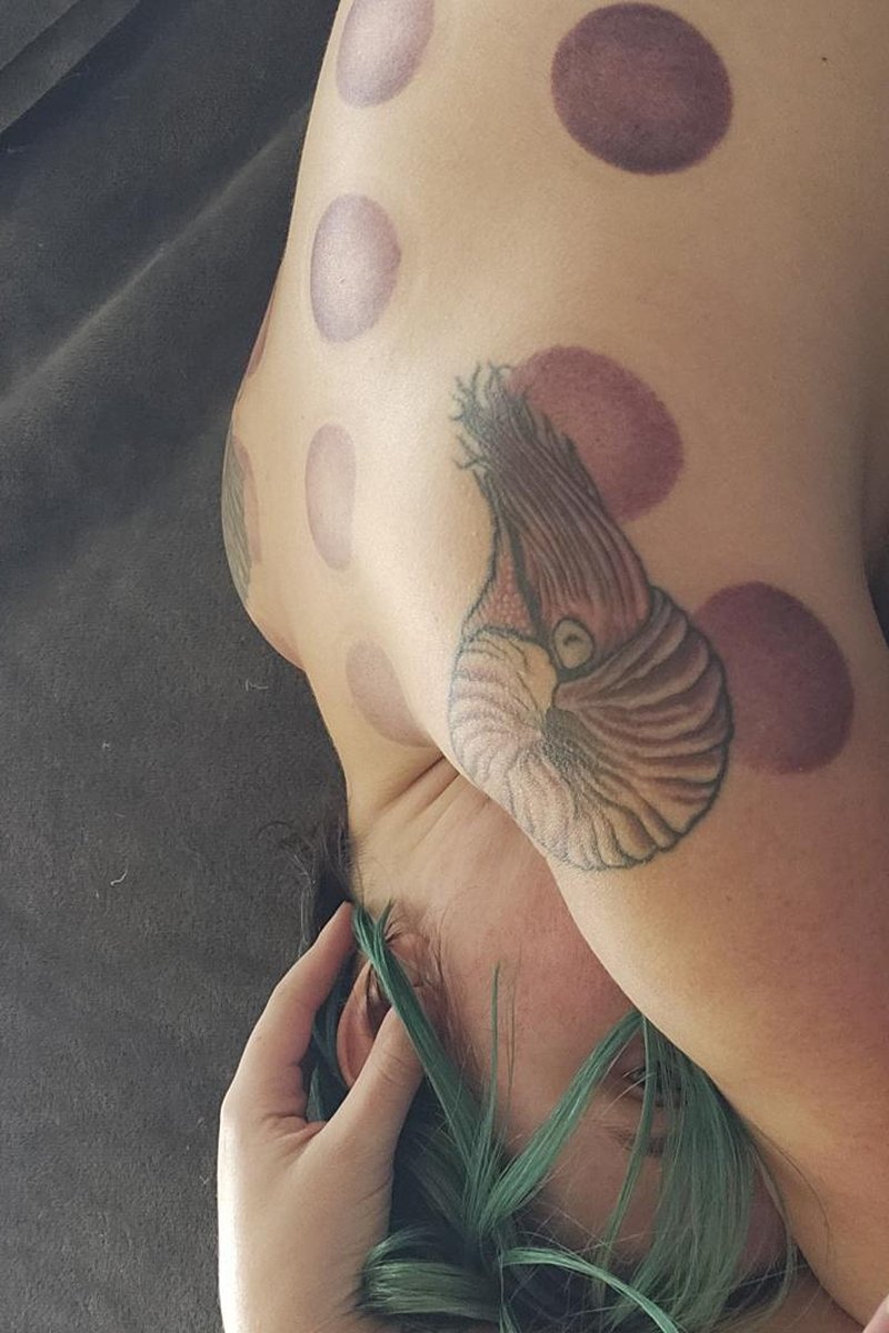 Bruises - Screenshot 1 of 4 - Ass Worship