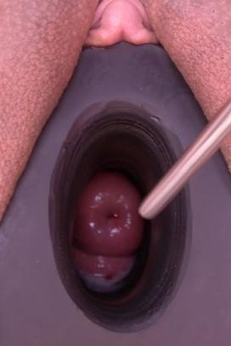 Deep Cervix Sounding - Screenshot 1 of 4 - BDSM