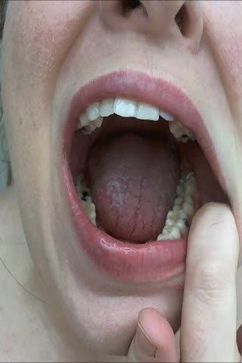 Teeth Lips - Screenshot 1 of 4 - Fetish
