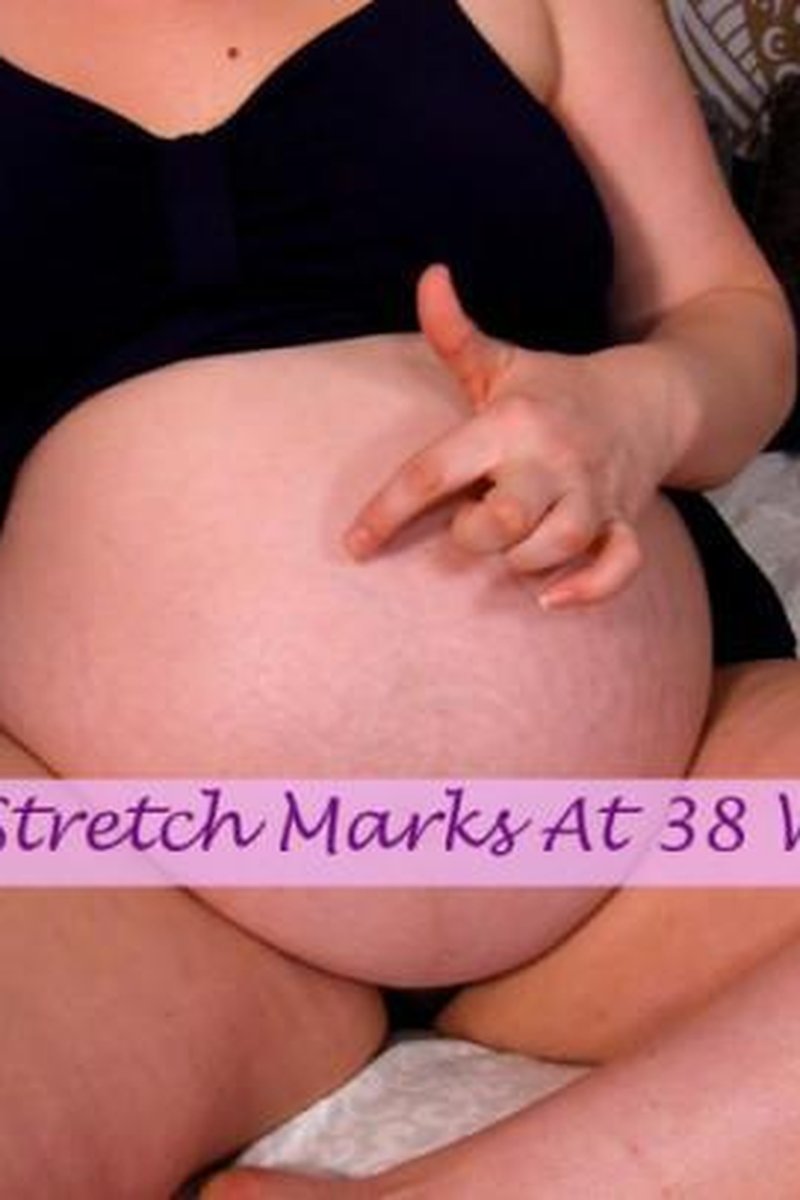 Stretch Marks On My Pregnant Belly - Screenshot 1 of 4 - BBW