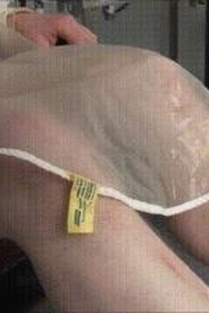 Plastic Induction - Screenshot 1 of 4 - Asphyxiation