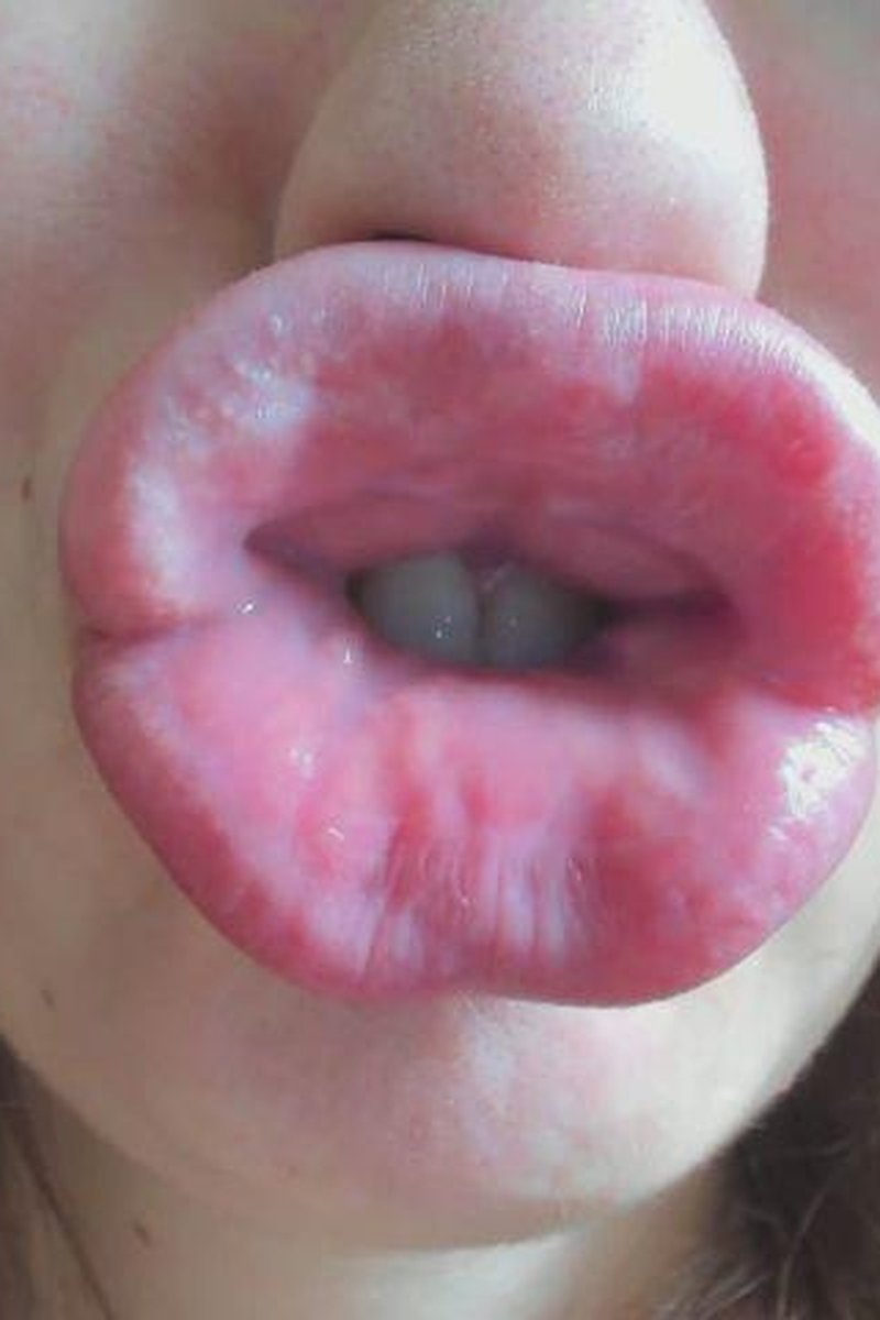 Big Square Lips - Screenshot 1 of 4 - Close Up